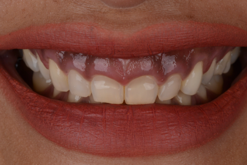 Niagara Periodontics & Associated Specialties St. Catharines Dental office Dentist